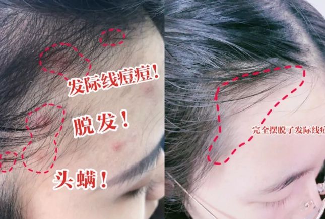 吹干好？10分钟轻松养成女明星「绸缎发」AG真人游戏第一品牌洗完头自然风干还是(图11)